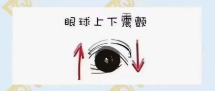 什么是眼球震顫？